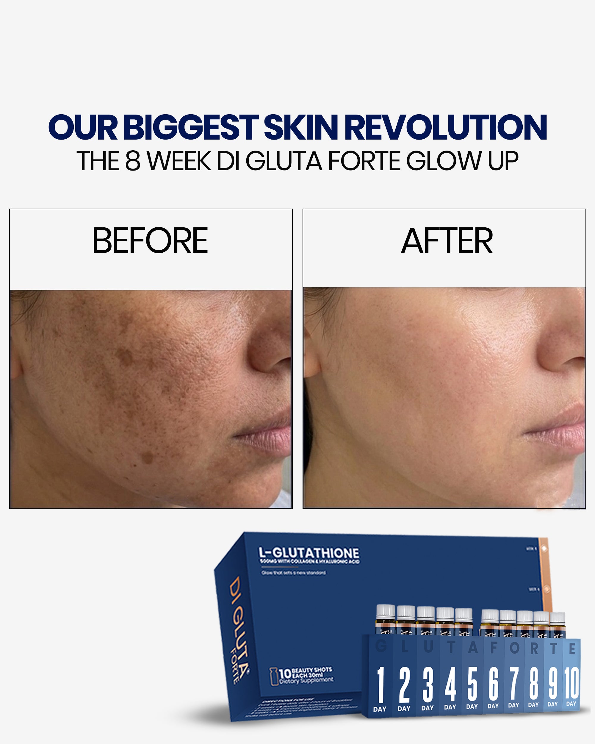 DI GLUTA FORTE