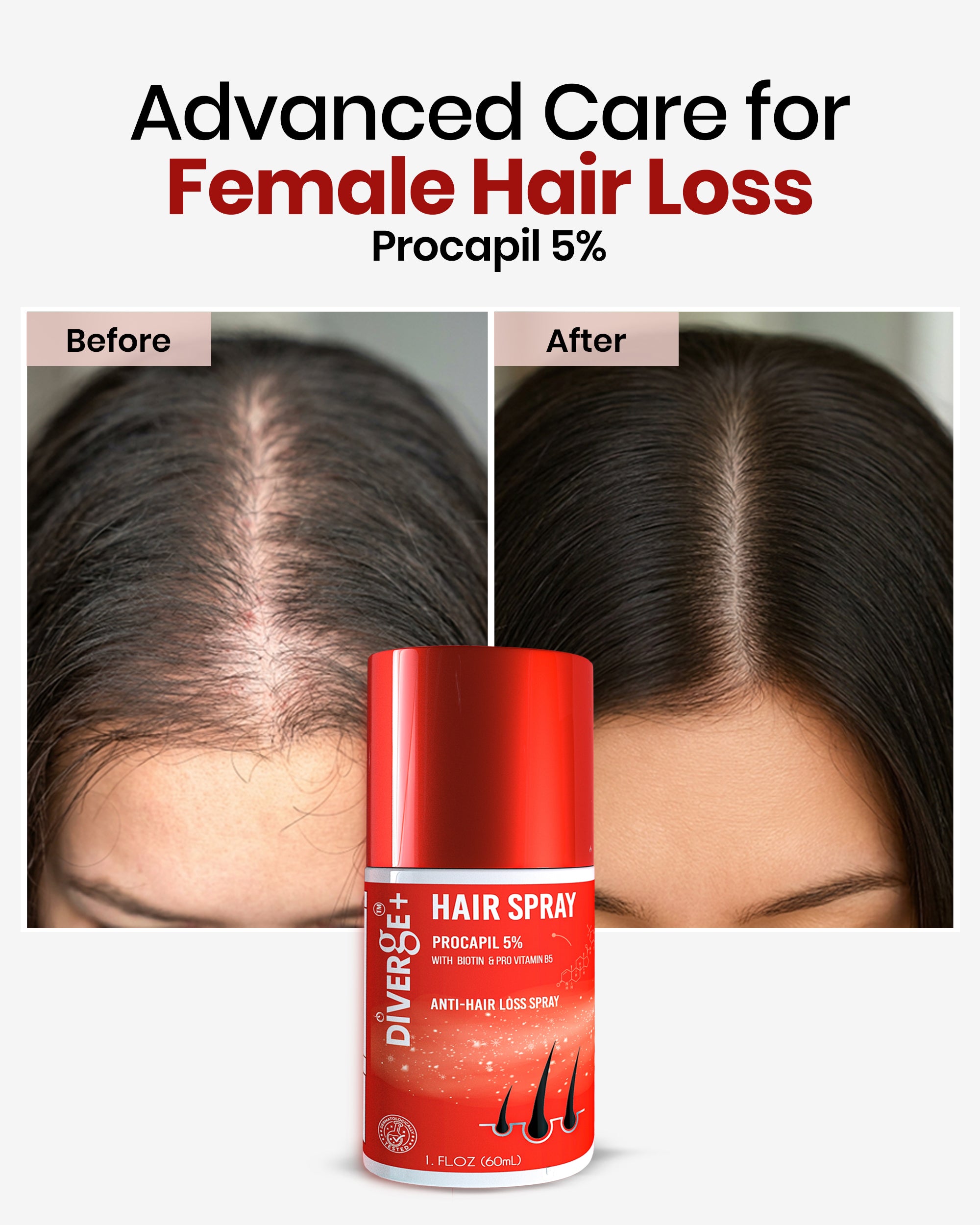 DIVERGE + HAIR SPRAY