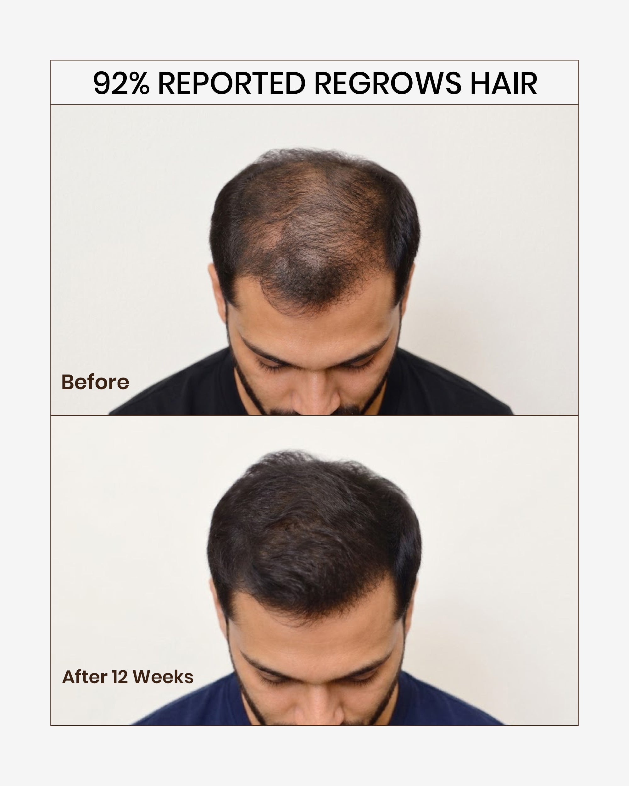 DIVERGE HAIR SERUM