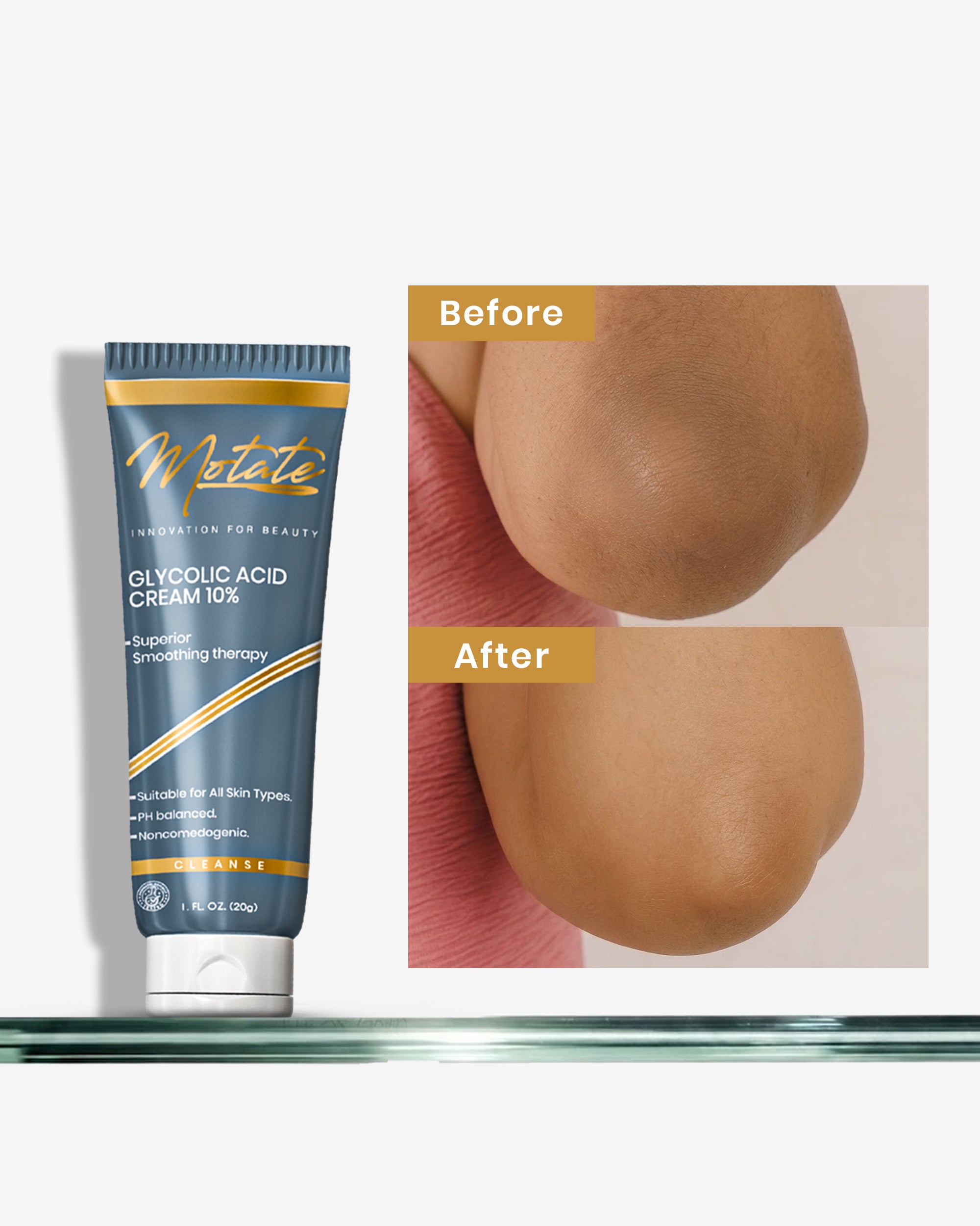MOTATE GLYCOLIC ACID CREAM 10%
