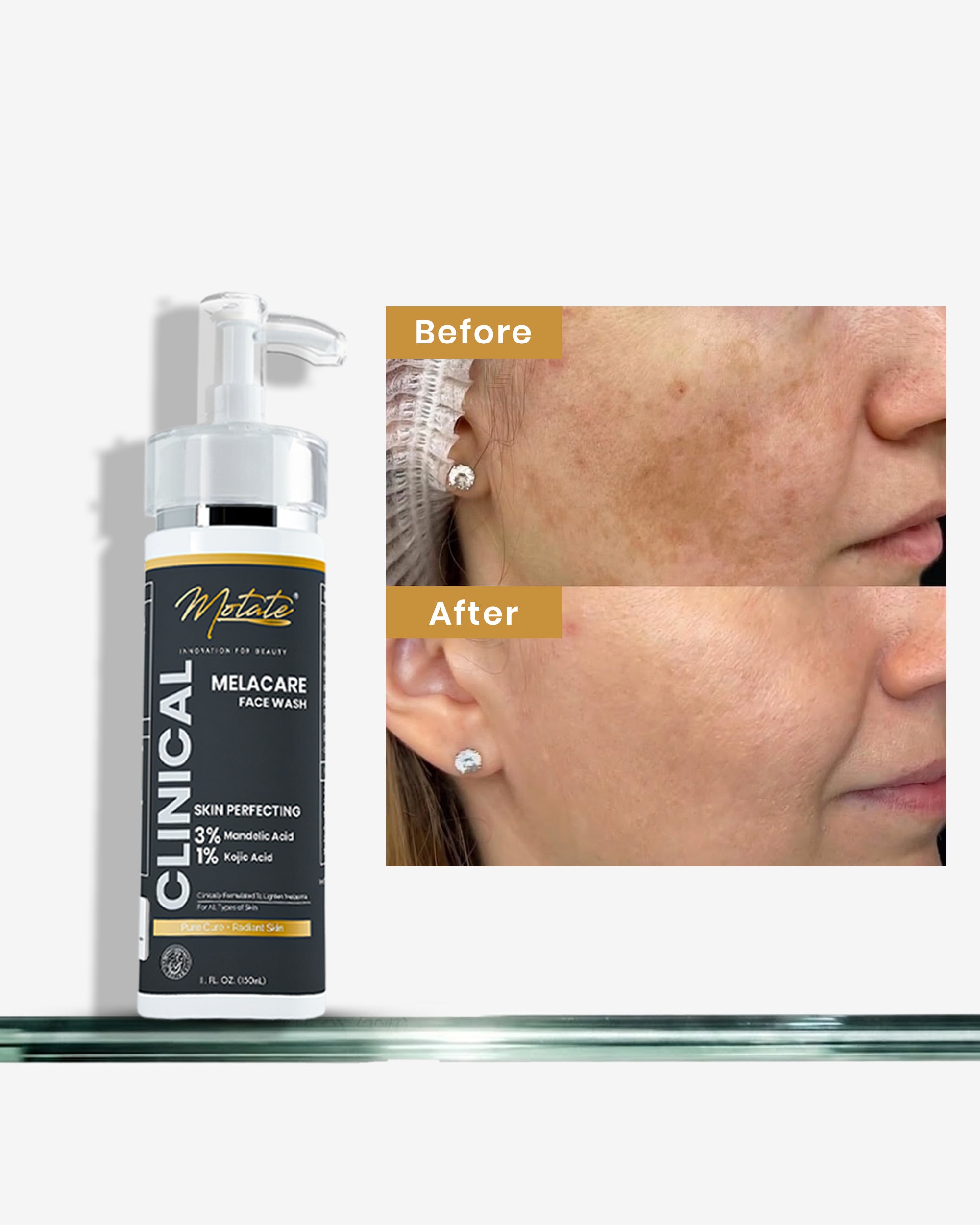 MOTATE MELACARE FACE WASH