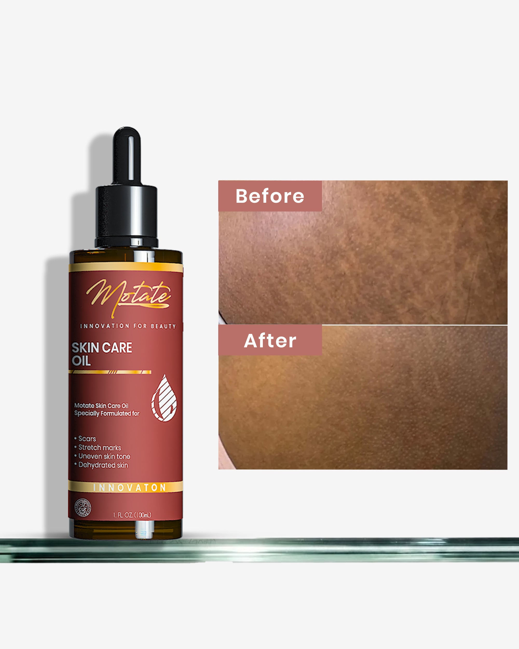 MOTATE SKIN CARE OIL