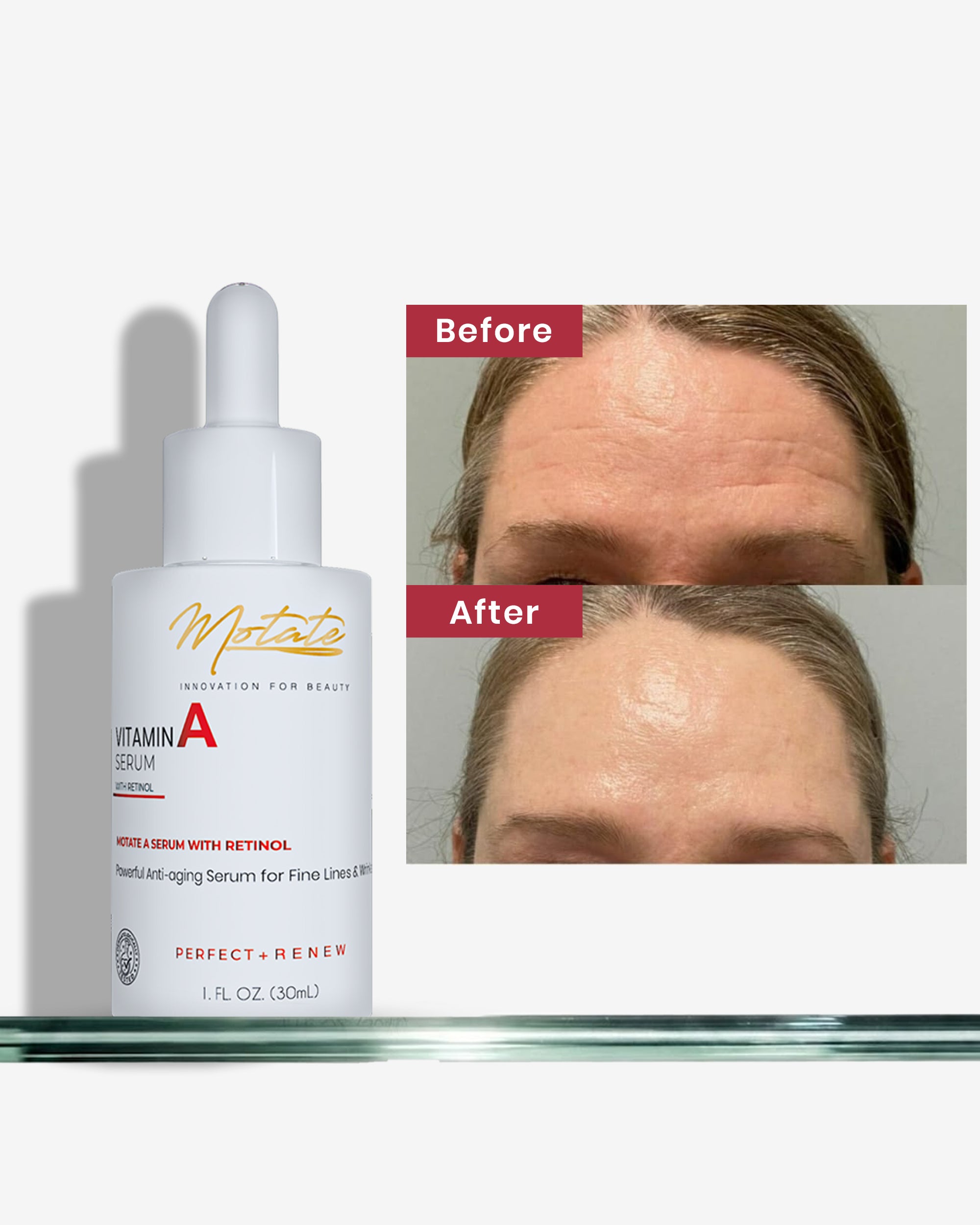 MOTATE VITAMIN A SERUM