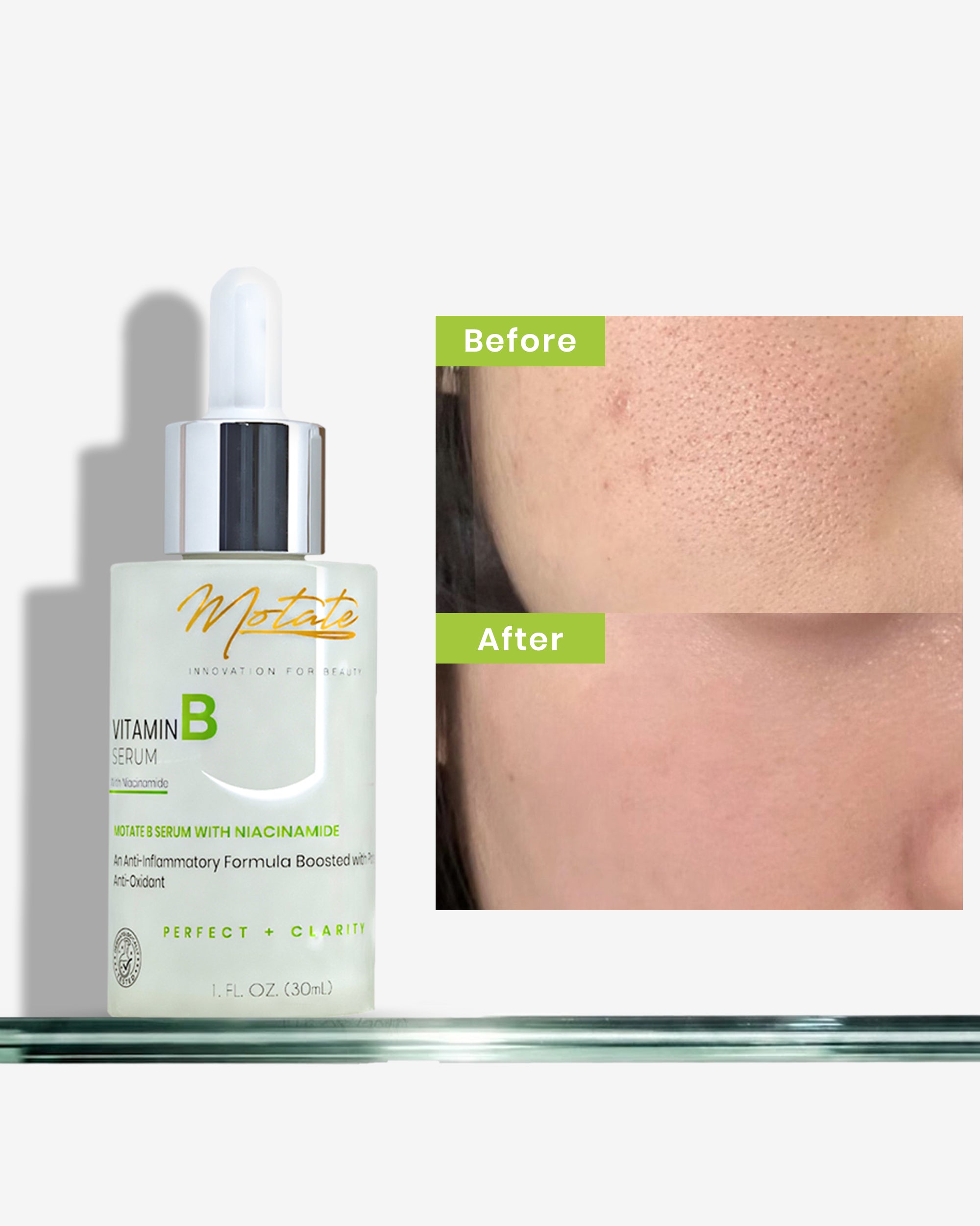 MOTATE VITAMIN B SERUM